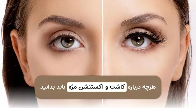 تفاوت کاشت و اکستنشن مژه + نکات مهم مراقبت قبل و بعد