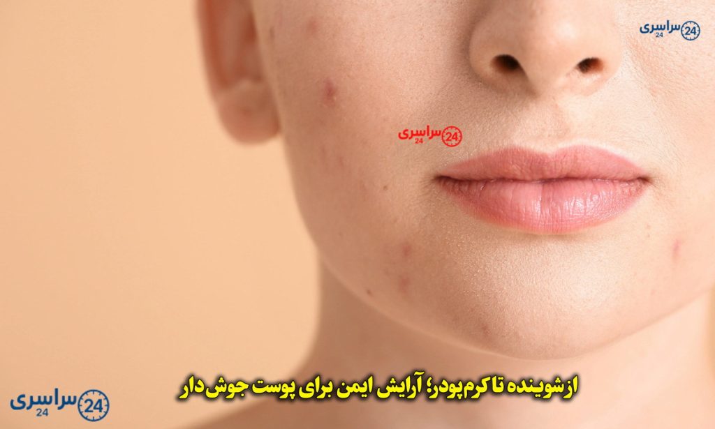 آرایش با پوست مستعد آکنه؛ راهنمای واقعی و بدون اغراق