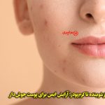 آرایش با پوست مستعد آکنه؛ راهنمای واقعی و بدون اغراق