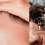 آیا داروی کلاسکوترون می‌تواند درمان جدید ریزش موی آندروژنیک مردانه باشد