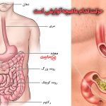 جواب کامل سؤال حرکت کدام ماهیچه گوارشی است