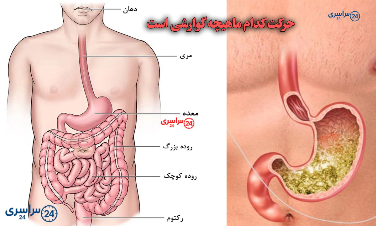 جواب کامل سؤال حرکت کدام ماهیچه گوارشی است