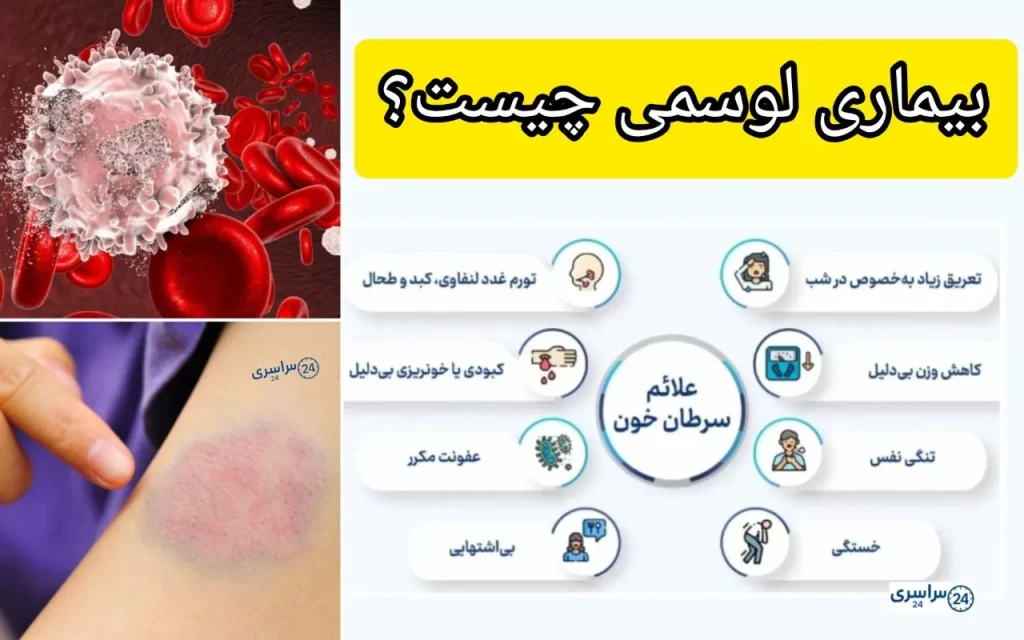 بیماری لوسمی چیه + انواع لوسمی ، علائم و روش های درمان