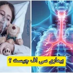 بیماری سی اف چیست ؟ + از ژن معیوب تا علائم واقعی