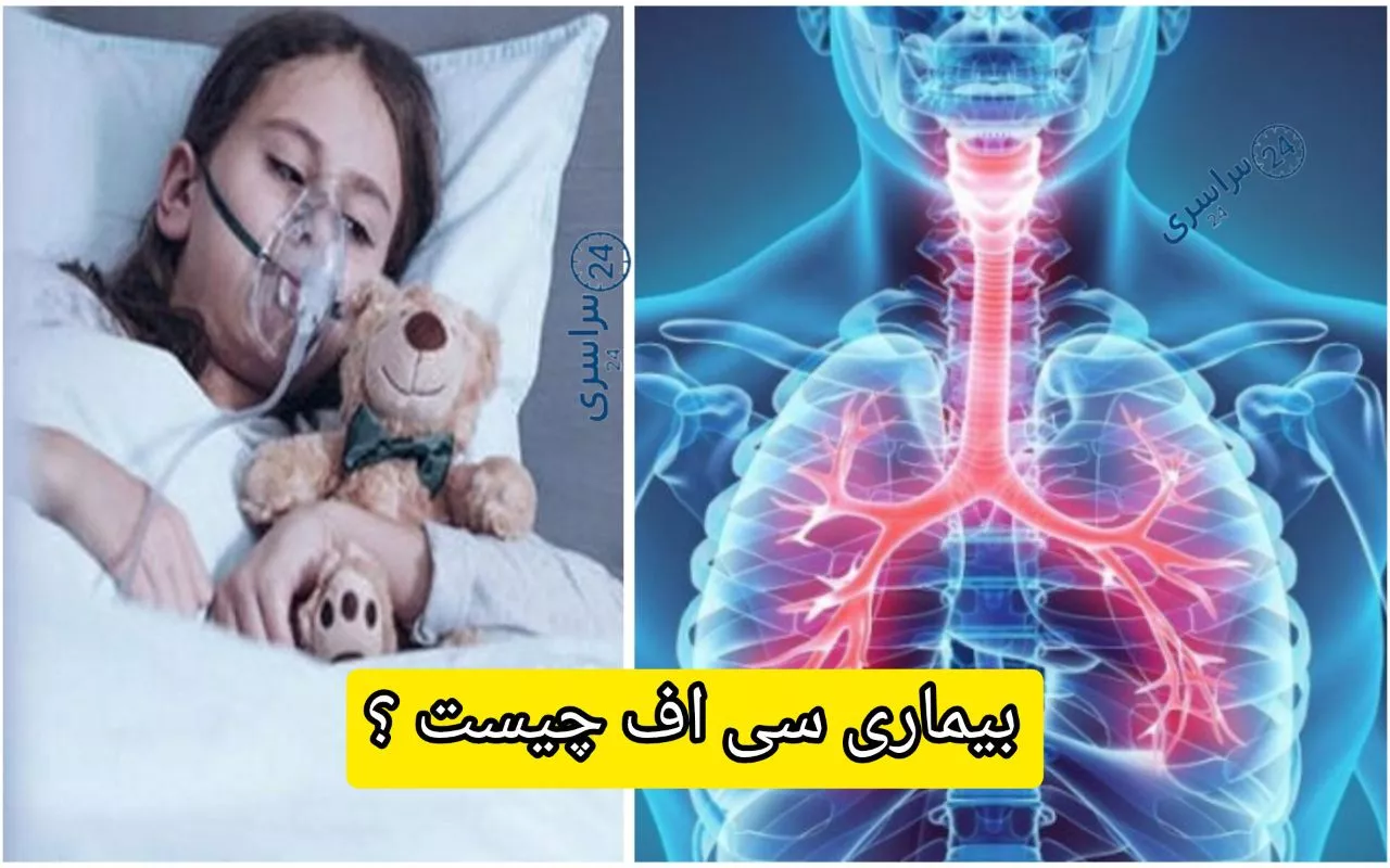 بیماری سی اف چیست ؟ + از ژن معیوب تا علائم واقعی