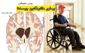 بیماری هانتینگتون چیست؟ + علائم، علت و درمان