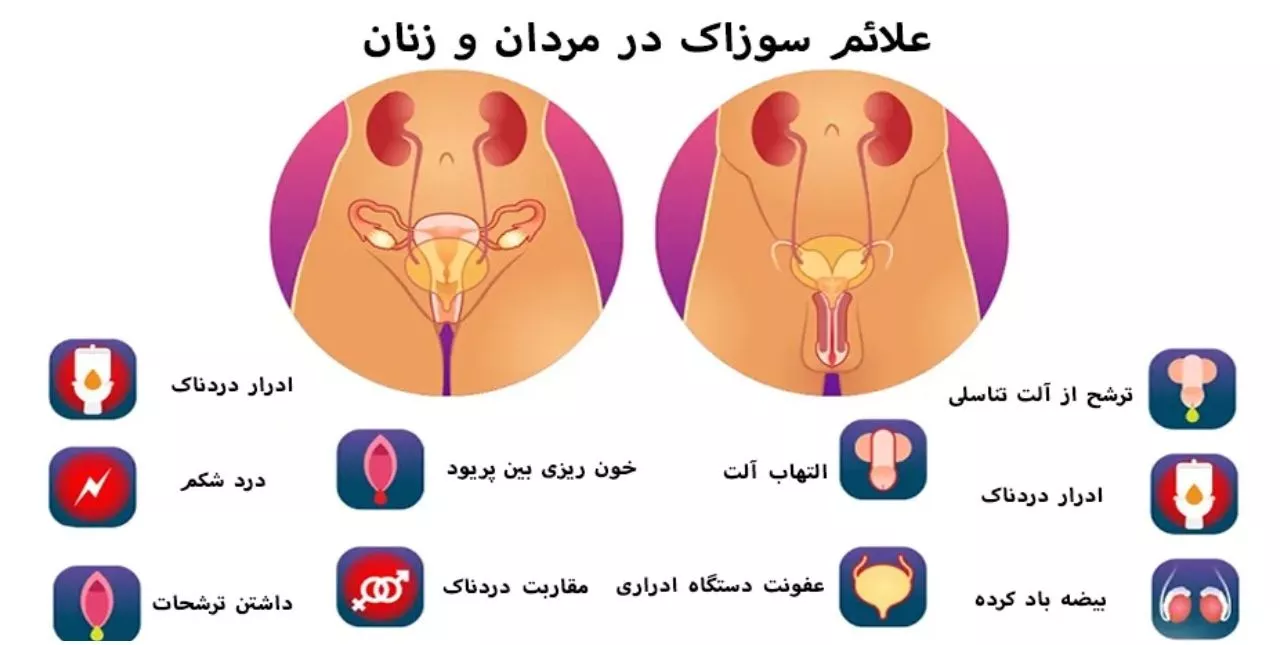 بیماری آتشک در انسان + سوزاک و علائم پنهان و راه درمان