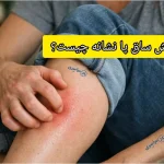 خارش ساق پا نشانه چیست؟ از دلایل واقعی تا فال
