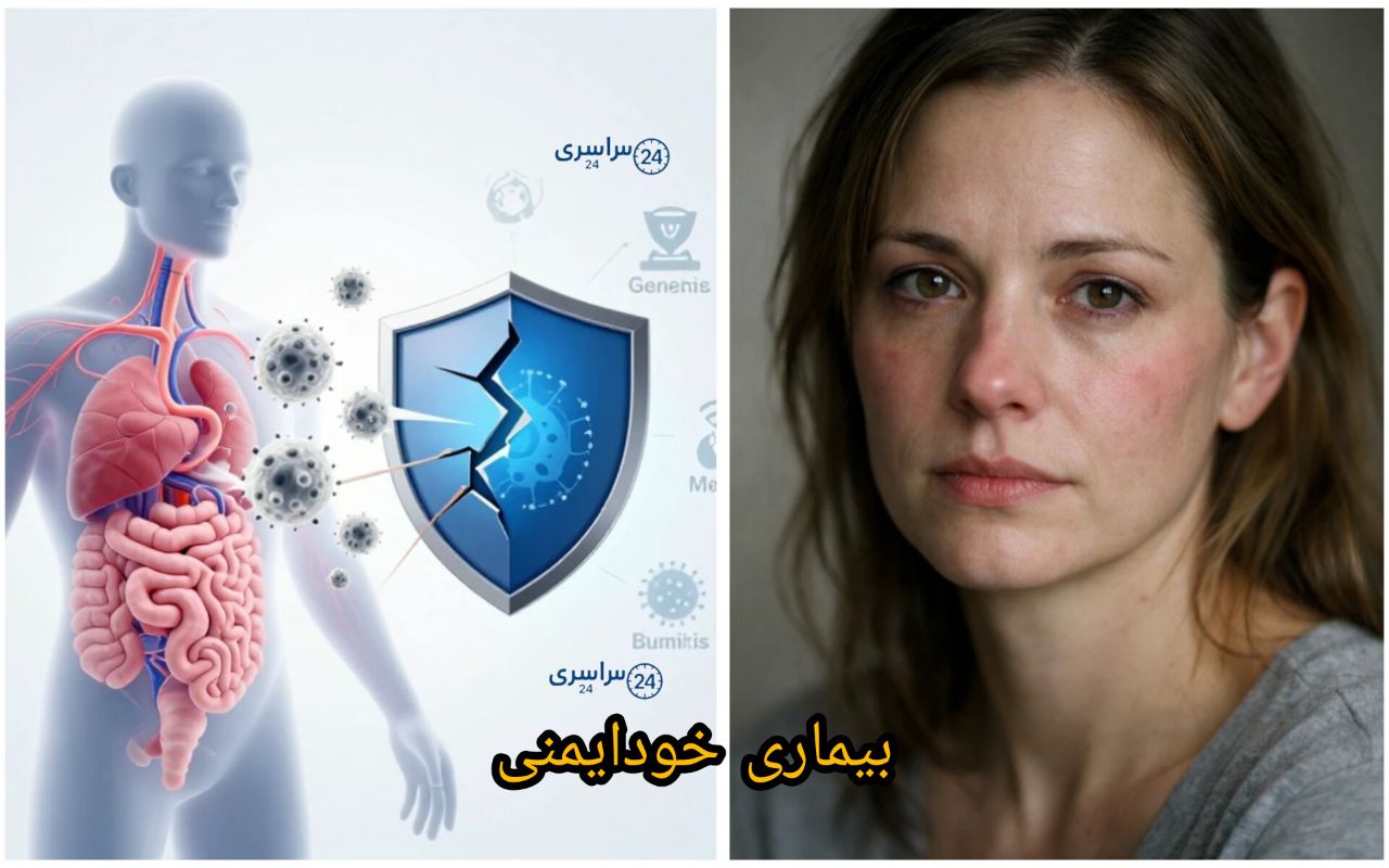 بیماری خودایمنی چیست ؛ علائم نهفته و آشکار + روش درمان و کنترل