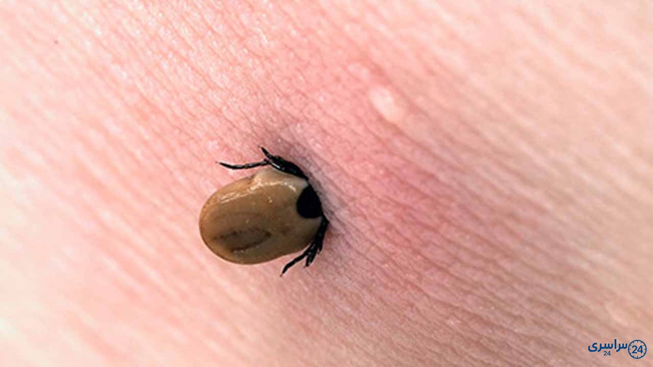 عکس کنه