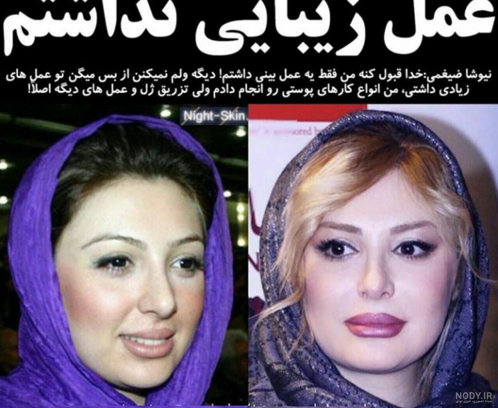 تغییر چهره نیوشا ضیغمی