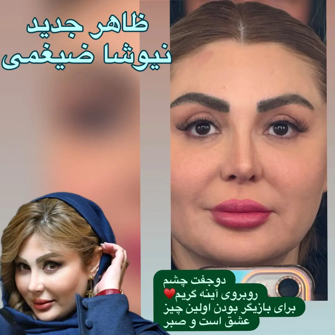 تغییر چهره نیوشا ضیغمی