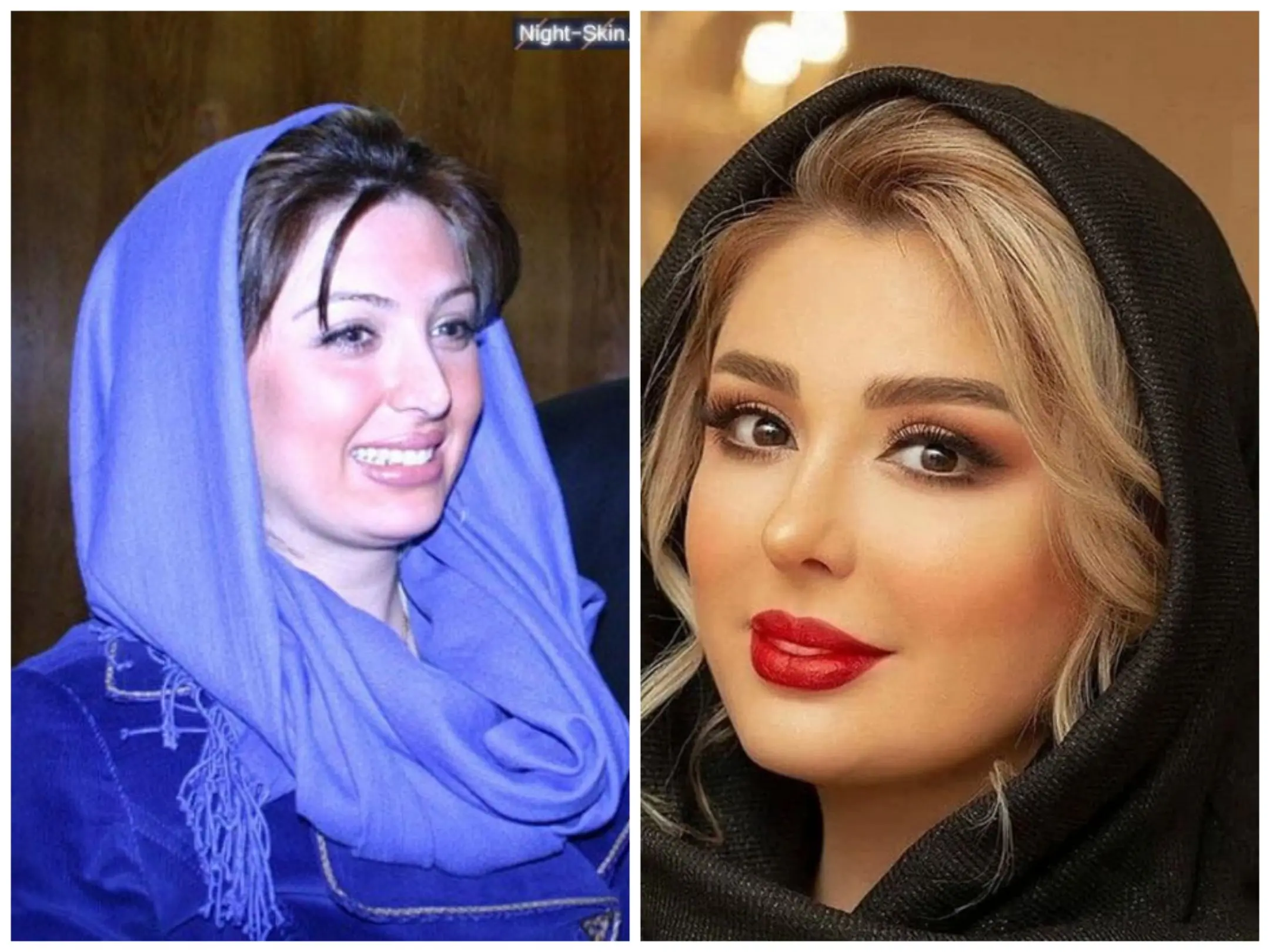 تغییر چهره نیوشا ضیغمی