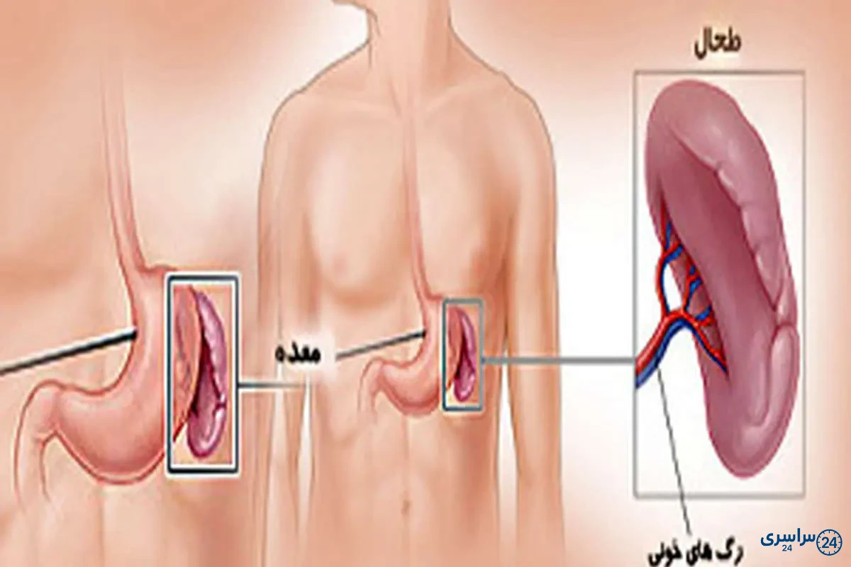 عکس طحال
