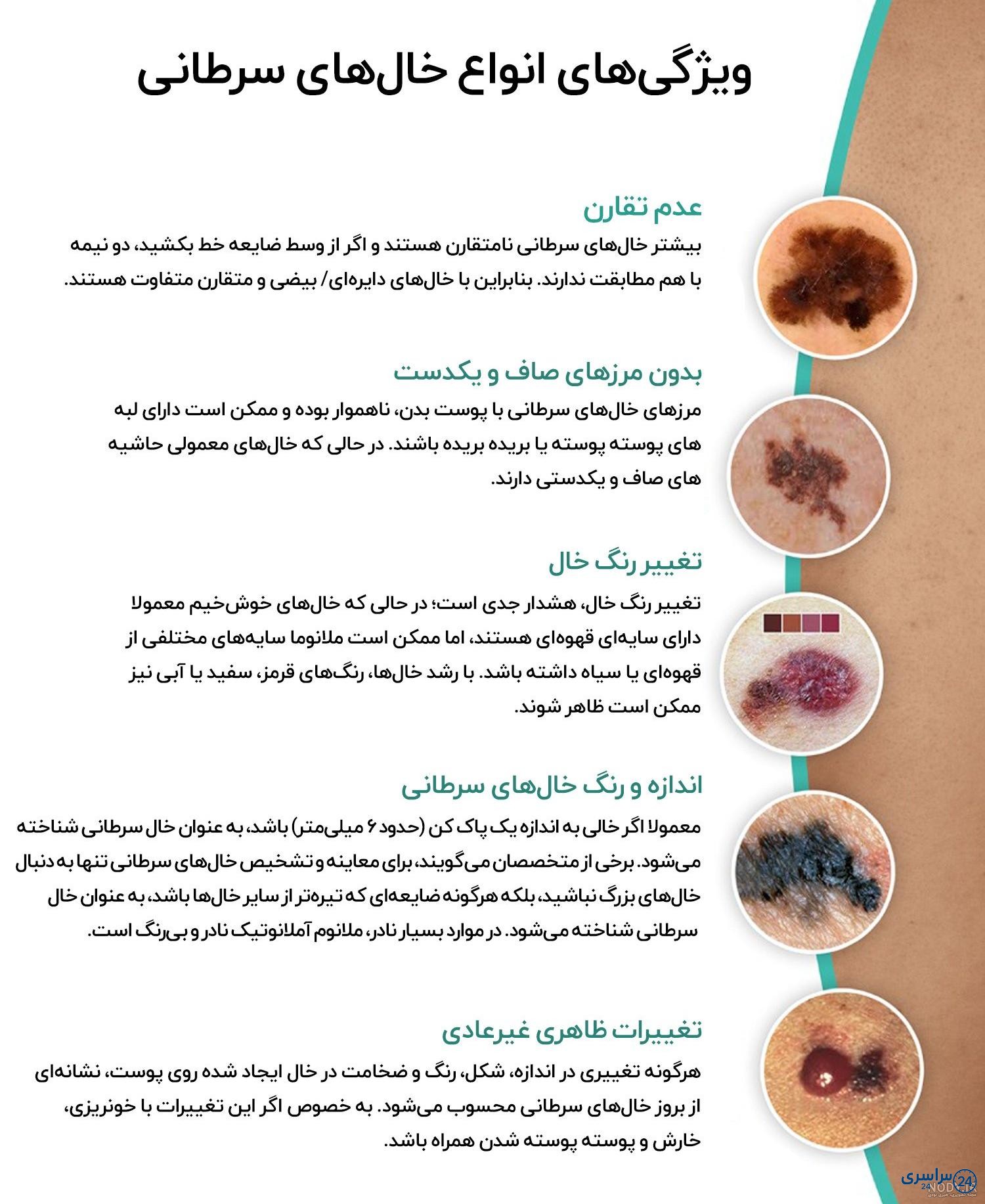 عکس خال های سرطانی